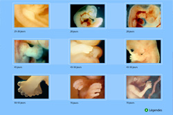 l'�volution du foetus en photo - diaporama